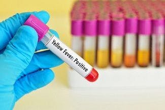 First Clinical Trial Launched for Yellow Fever Treatment Candidate