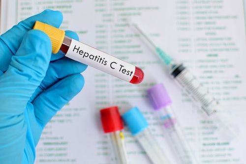 Testing Still Needed After HCV Clears in HIV-Positive MSM
