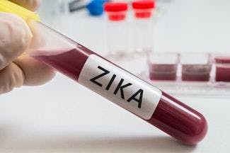 Cytokines in Blood of Pregnant Women with Zika May Help Develop Prenatal Screening for Zika-Related Birth Defects
