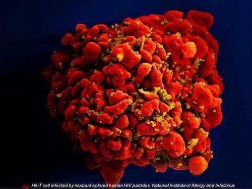 HIV-1 Genetic Diversity Higher in Vaginal Tract Than Blood