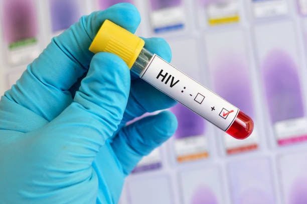 HIV positive test | Image Credits: Unsplash