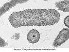 Previously Misdiagnosed Bacteria Cause for 18 Deaths