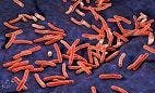 Protein Found to Protect Against Mycobacterium tuberculosis