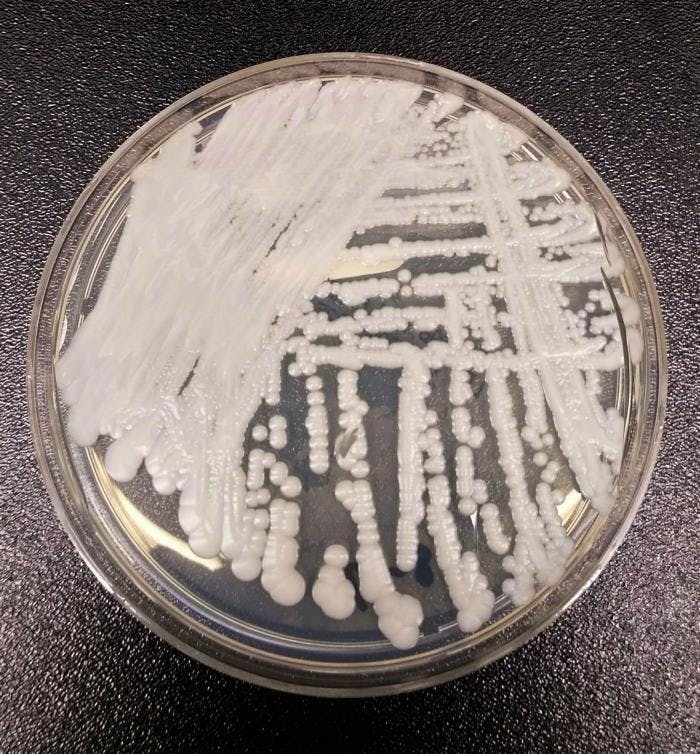 Candida Auris: An Emerging Fungal Infection That Warrants Our Attention