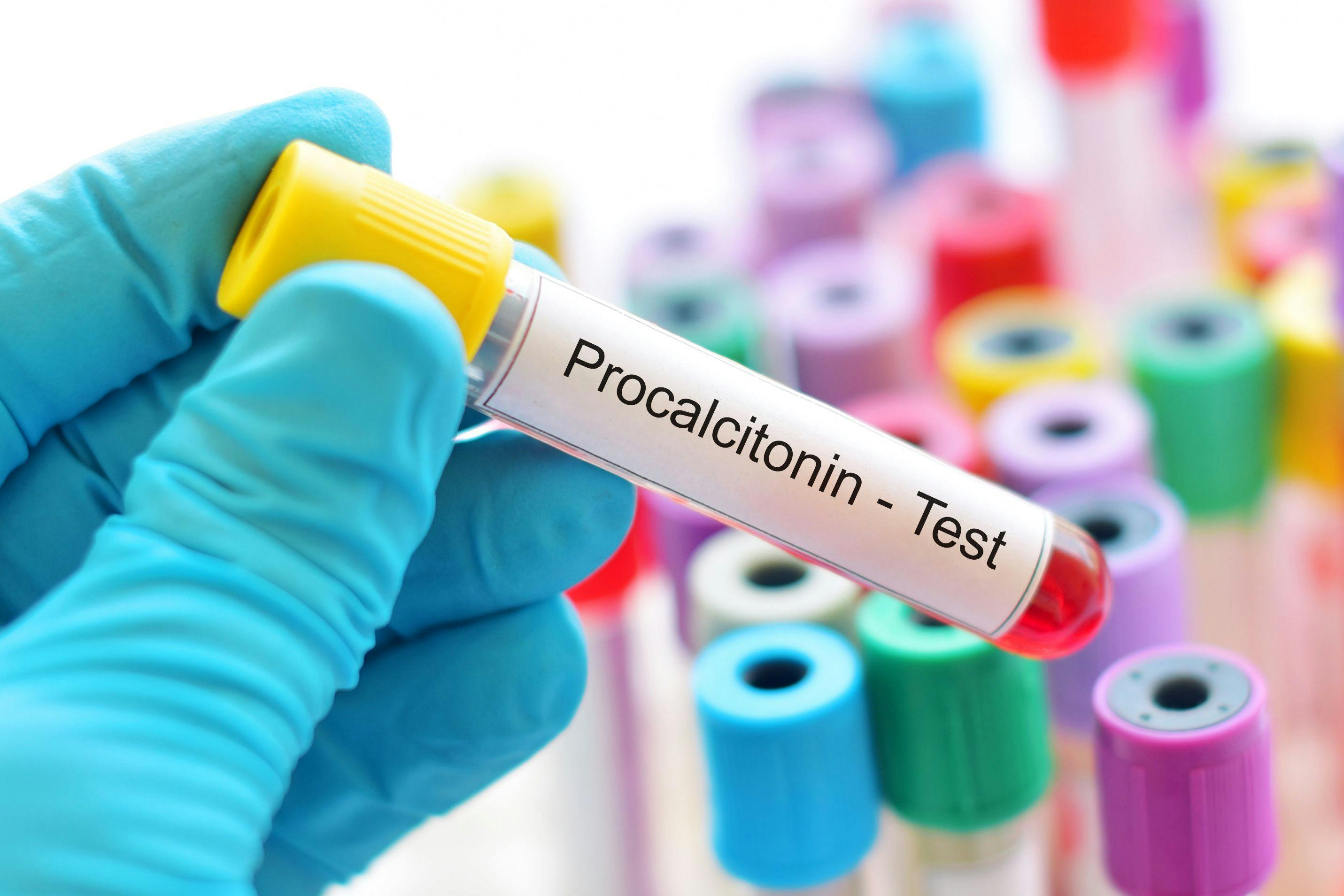 Investigators used procalcitonin (PCT) levels to guide antibiotic recommendations in pediatric intensive care units. PCT-guided antibiotic stewardship decreased the number of antibiotic days without leading to therapy failure.