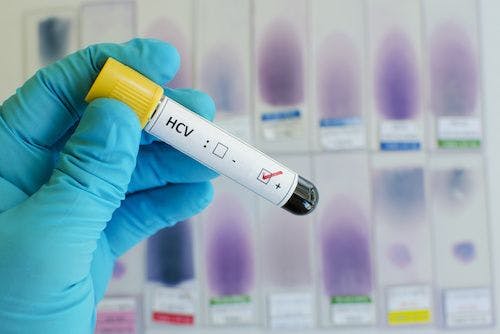 HCV Testing Remains Low Among High-Risk Population
