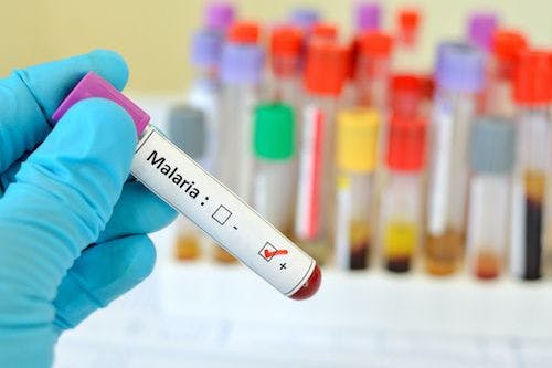 CDC Announces IV Artesunate as New First-Line Treatment for Severe Malaria