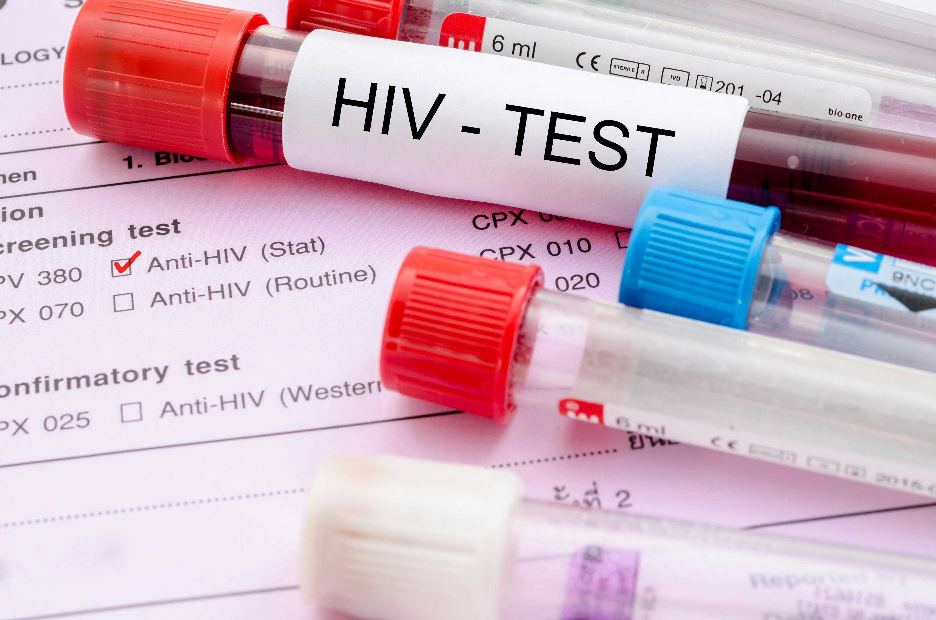 New, Highly Virulent HIV Variant Found in the Netherlands