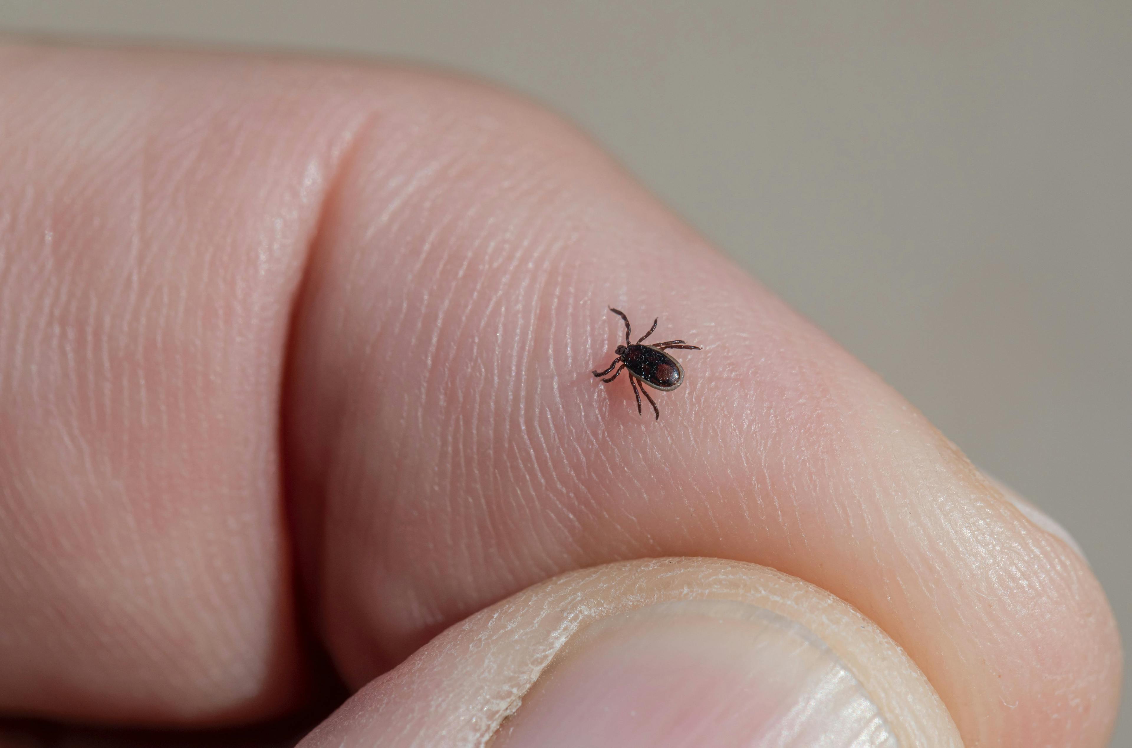 Lyme Disease: Has it Been Underreported? 