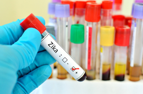 Hundreds of Blood Samples Retested for Zika Due to False Negative Results