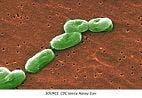 Antibiotic-Resistant Bacteria Cause Multistate Outbreak