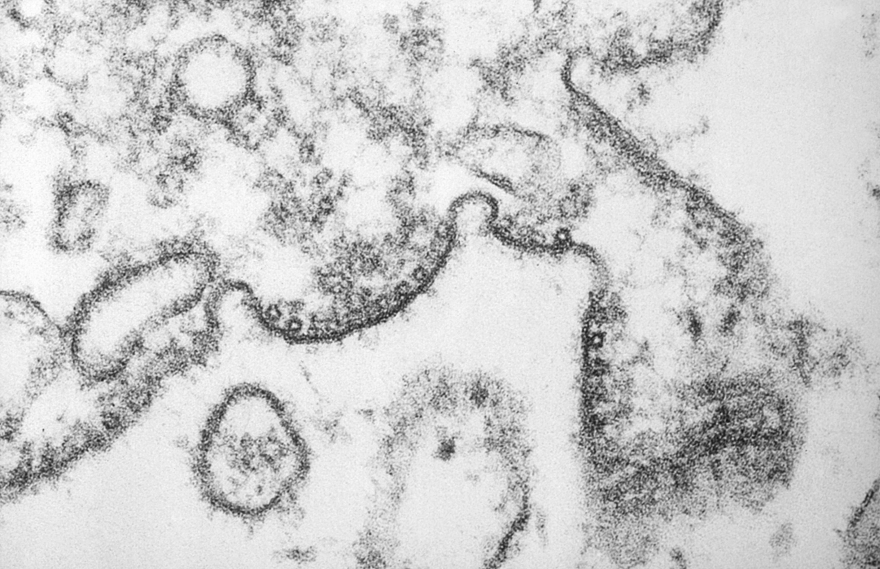 Nipah Virus Discovered in India