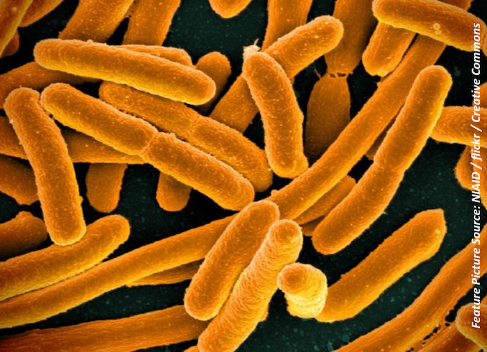 Tracing ESBL E coli in the UK: Human Hygiene Contributes More to Infection Than Food Chain