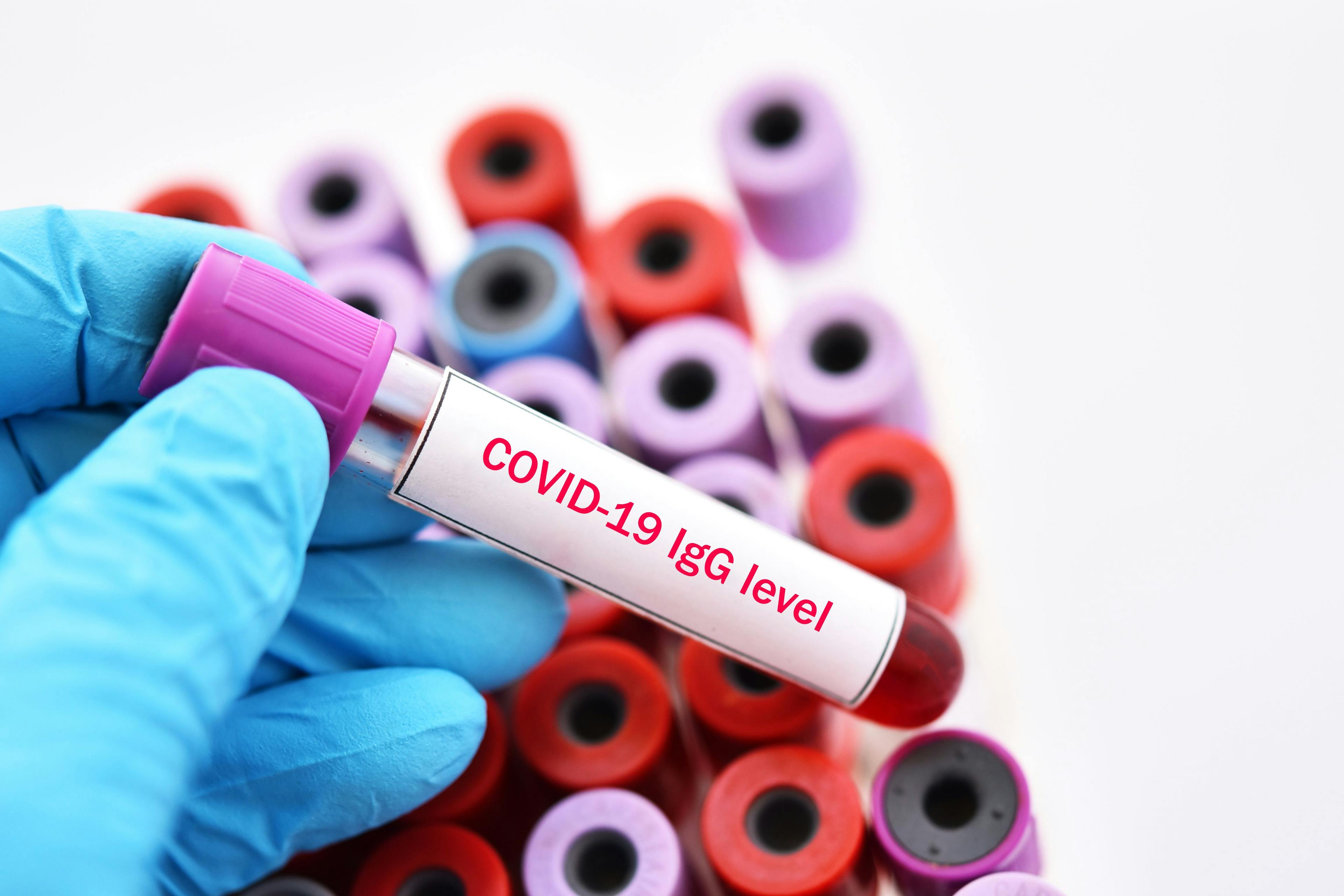 Longer Intervals Between COVID-19 Vaccine Doses Leads to Higher Antibody Levels 