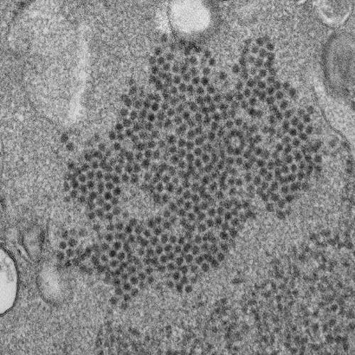 More Evidence Supports an Enterovirus-AFM Link