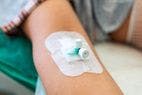  Peripheral Catheter to Administer Saline Could Be More Beneficial Than Central Catheters