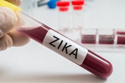 FDA Provides Assistance for Regulatory Evaluation of Serological Tests to Detect Recent Zika Infection