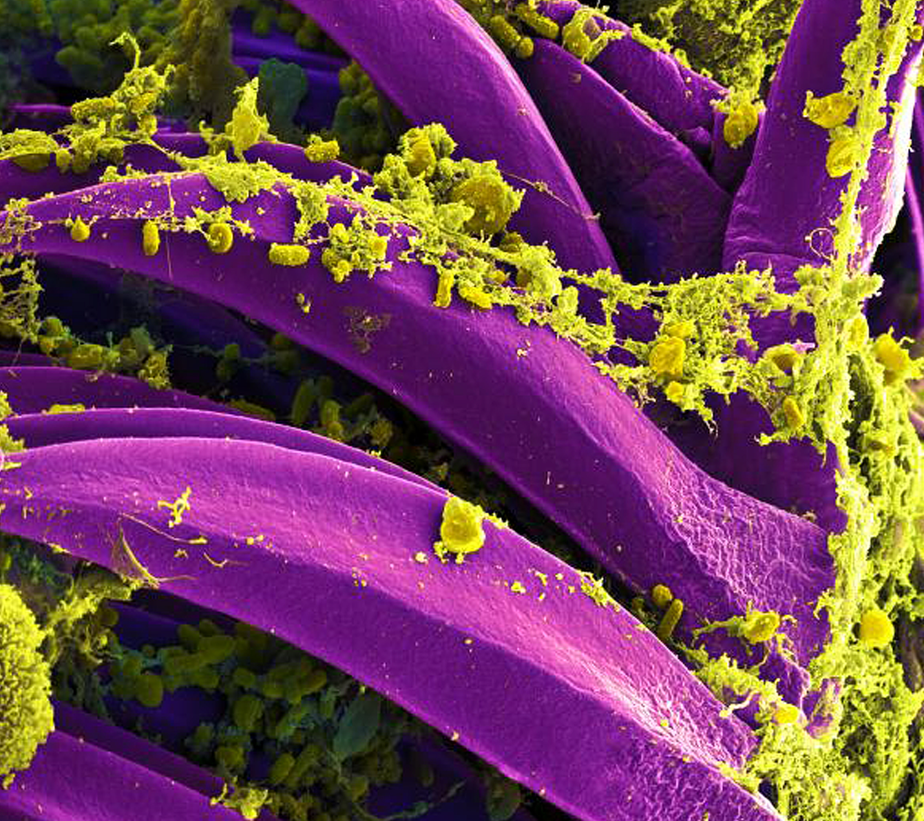 This digitally colorized scanning electron microscopic (SEM) image depicts a number of yellow-colored, Yersinia pestis bacteria, that had gathered on the proventricular spines of a Xenopsylla cheopis flea. These spines line the interior of the proventriculus, a part of the flea’s digestive system. The Y pestis bacterium is the pathogen that causes bubonic plague.

Image Credit: National Institute of Allergy and Infectious Diseases