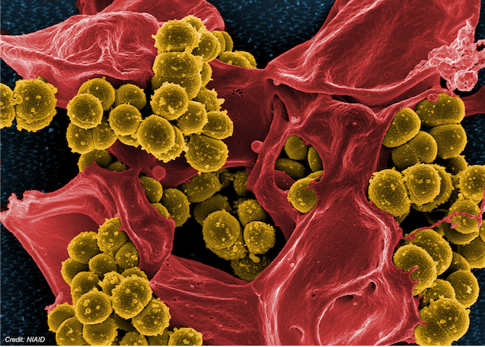 A “Substantial Proportion” of Hospital MRSA Infections Occur Post-Discharge, Study Concludes: Public Health Watch