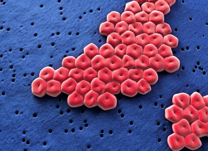 microscopic image of Acinetobacter baumannii bacteria