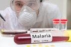 Malaria Diagnostic Test Safely Determines Infection During Ebola Outbreak