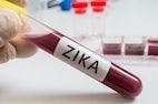 Zika Test Yields False Positives as Brazilian Women Continue to Avoid Pregnancy