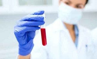 Estimating HIV Screening Incidence Among US Citizens