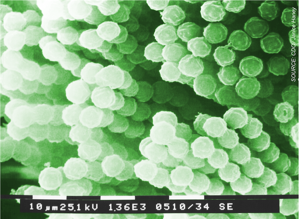 Investigational Rezafungin Shows In Vitro Activity Against Azole-Resistant Aspergillus