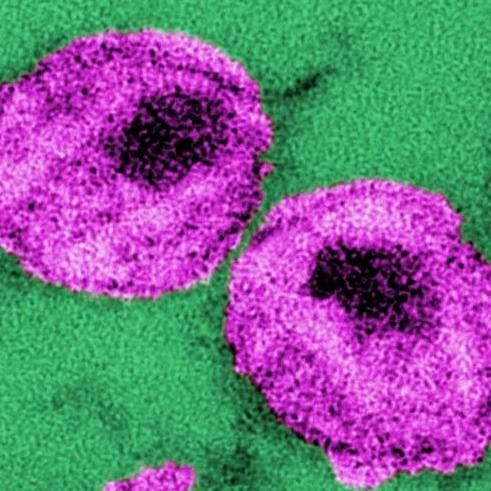 HTI Vaccine Regimen Shows Immunogenicity in HIV Patients