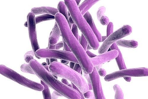 Researchers Develop New Algorithm for Diagnosing Tuberculosis in Patients With HIV