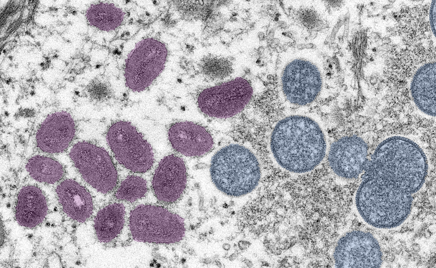 investigators found potentially infectious monkeypox virus DNA in saliva and semen.