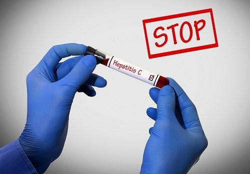 What Is Needed to Eliminate Hepatitis C Virus in the US?