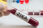 Zika Vaccine Proves Effective in Monkeys