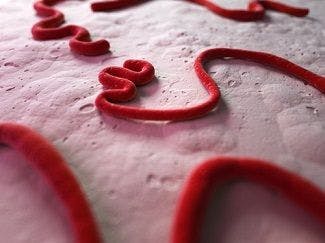 Human Protein Blocking Ebola Virus Growth May Lead to New Treatment