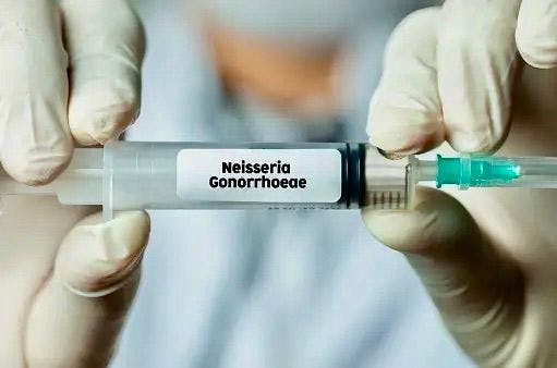 Neisseria gonorrhoeae treatment | Image Credit: Unsplash