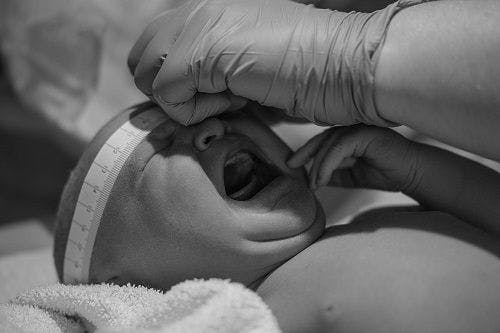 Zika Infection Late in Pregnancy May Impact Fetal Neurologic Development
