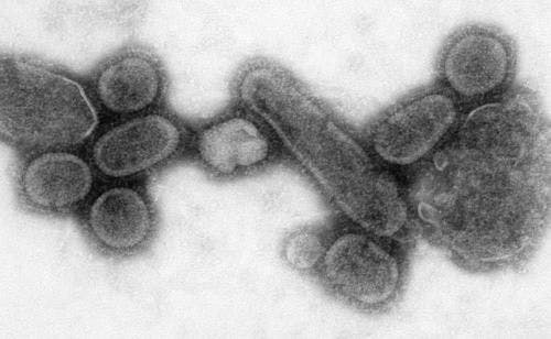 Analysis: Spanish Flu Pandemic Proves Social Distancing Works
