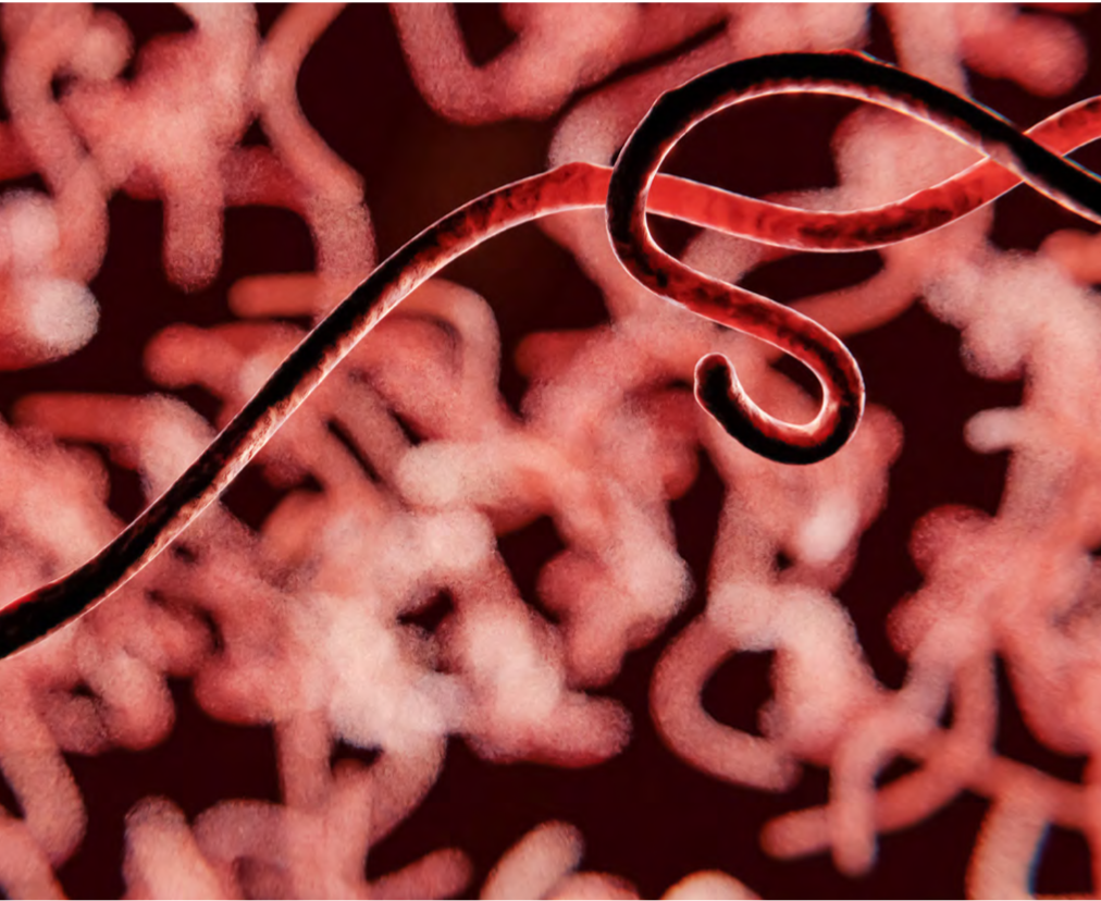Treating Zaire ebolavirus With Ansuvimab-zykl