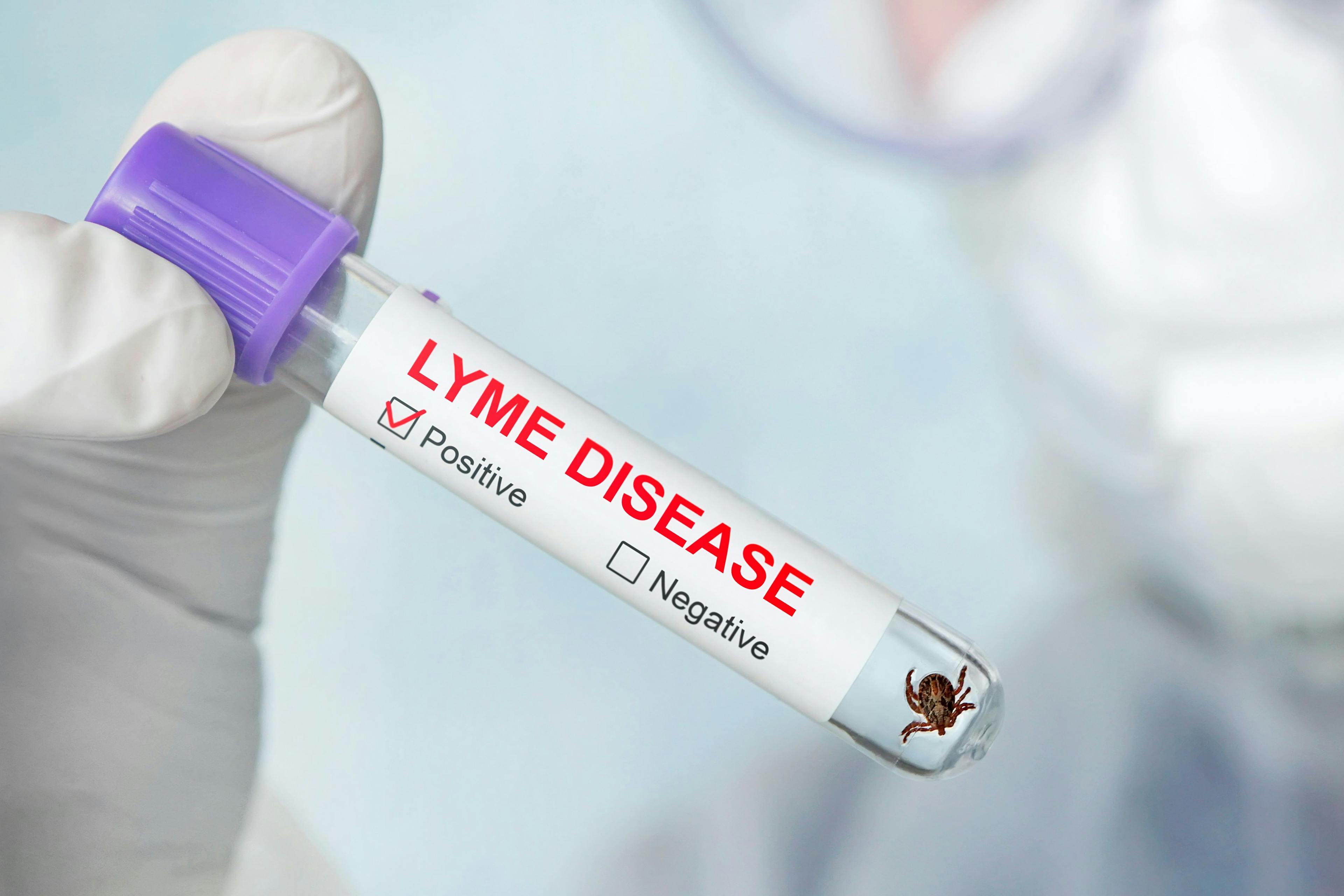 A Tufts University research time identified a novel testing method to detect Lyme disease reinfection and successful treatment.