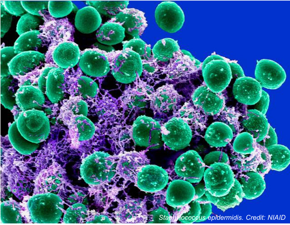 The Rise of Resistant Staphylococcus epidermidis