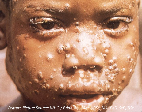 Assessing the Threat of Monkeypox in the Post-Smallpox World