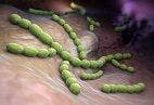 New Study Shows Why Pneumococcal Infections Affect Humans