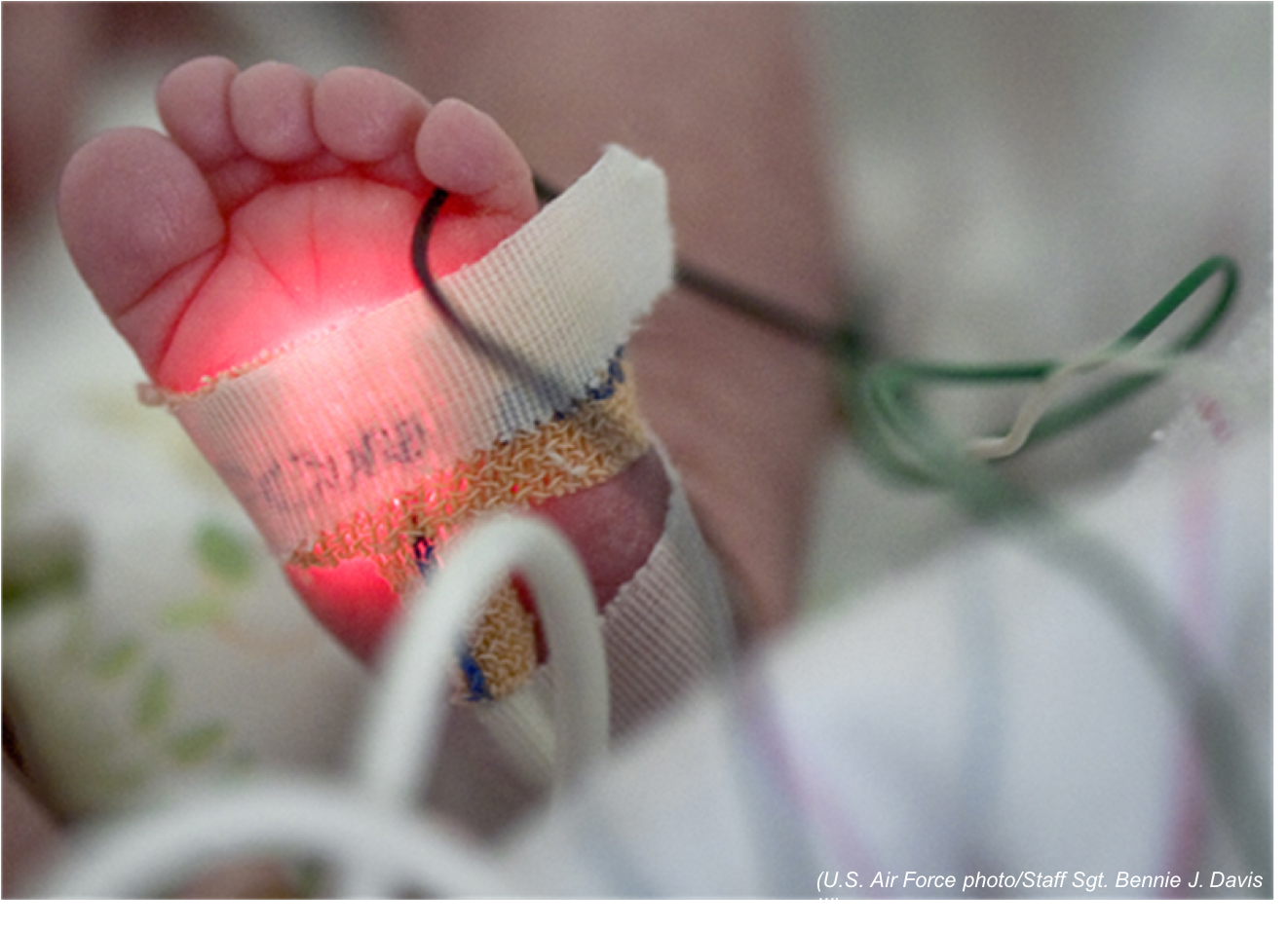 JAMA Study Suggests Antibiotic Use Among Premature Infants May Be Unnecessarily High: Public Health Watch