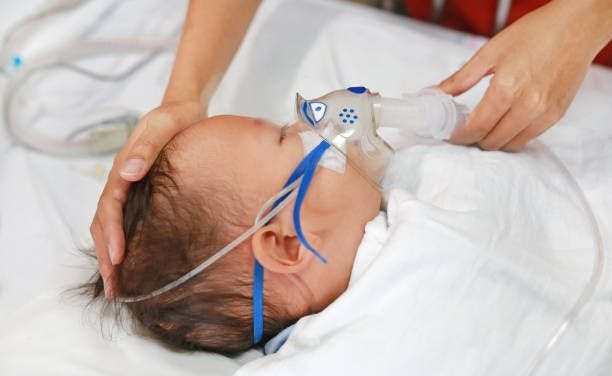 Infant hospitalized for RSV | Image Credits: Unsplash